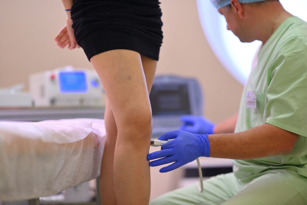 varicose leg treatment